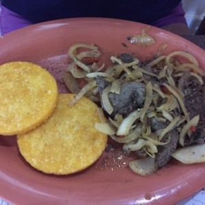 higado encebollado